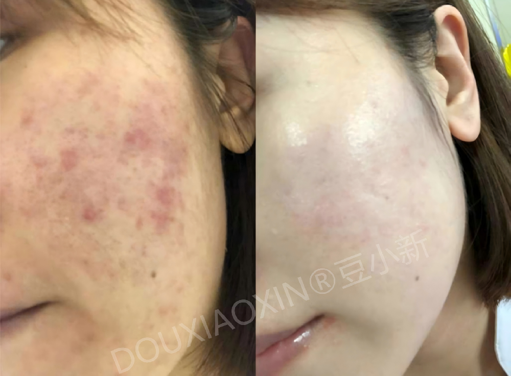 ��С�¶�ӡ����