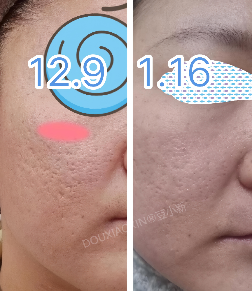 ��С�¶��Ӱ���